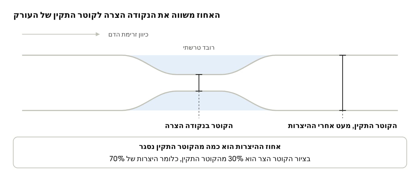 איור: חישוב אחוז ההיצרות בשיטת NASCET
